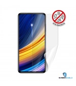 Screendshield Anti-Bacteria XIAOMI POCO F3 folie na displej